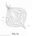 Fig. 13 - False lumen occluder