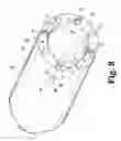 Fig. 09 - LATERALLY EXPANDING SURGICAL DILATOR