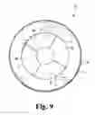 Fig. 10 - LATERALLY EXPANDING SURGICAL DILATOR