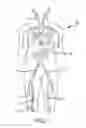 Fig. 02 - Devices and methods for treating venous diseases