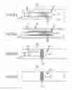 Fig. 03 - Devices and methods for treating venous diseases