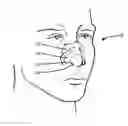 Fig. 01 - Nasal dilator