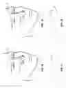 Fig. 07 - Nasal dilator