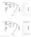 Fig. 10 - Nasal dilator