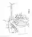 Fig. 03 - Surgical Tool with Crossbar Lever