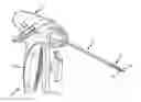 Application 20120022584, fig. 01