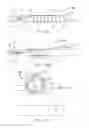 Fig. 31 - Systems and methods for treating septal defects