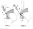 Fig. 08 - METHOD FOR SECURING SUTURES TO BONES