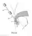Fig. 09 - METHOD FOR SECURING SUTURES TO BONES