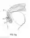 Fig. 10 - METHOD FOR SECURING SUTURES TO BONES