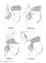 Fig. 12 - METHOD FOR SECURING SUTURES TO BONES