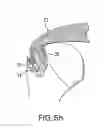 Fig. 15 - METHOD FOR SECURING SUTURES TO BONES