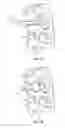 Fig. 02 - Injectable flexible interspinous process device system