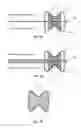 Fig. 05 - Injectable flexible interspinous process device system