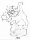Fig. 04 - Vertebral fixing system