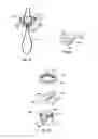 Fig. 13 - Bone fixing system and method of use