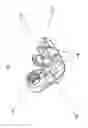 Fig. 02 - Sacral-iliac stabilization system
