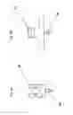 Fig. 06 - Sacral-iliac stabilization system