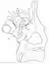 Fig. 01 - Vertebral fixing system