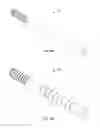 Fig. 10 - Minimally invasive surgical system
