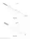 Fig. 13 - Minimally invasive surgical system