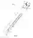 Fig. 41 - Minimally invasive surgical system