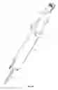 Fig. 45 - Minimally invasive surgical system