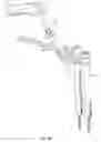 Fig. 46 - Minimally invasive surgical system