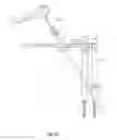 Fig. 49 - Minimally invasive surgical system
