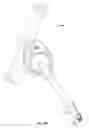 Fig. 60 - Minimally invasive surgical system