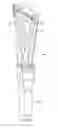 Fig. 62 - Minimally invasive surgical system