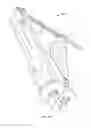 Fig. 63 - Minimally invasive surgical system