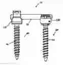 Fig. 01 - SPINAL FIXATION SYSTEM