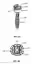 Fig. 05 - SPINAL FIXATION SYSTEM