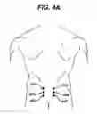 Fig. 07 - Minimally invasive spinal fixation guide systems and methods