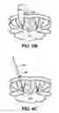 Fig. 08 - Minimally invasive spinal fixation guide systems and methods