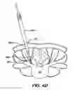 Fig. 09 - Minimally invasive spinal fixation guide systems and methods