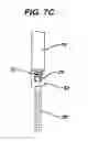 Fig. 16 - Minimally invasive spinal fixation guide systems and methods
