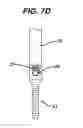 Fig. 17 - Minimally invasive spinal fixation guide systems and methods