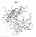 Fig. 19 - Minimally invasive spinal fixation guide systems and methods