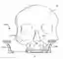 Fig. 01 - Method and internal apparatus for determining final position of dentate skeleton in orthognathic surgery