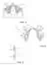 Fig. 03 - Method and internal apparatus for determining final position of dentate skeleton in orthognathic surgery