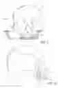 Fig. 05 - Method and internal apparatus for determining final position of dentate skeleton in orthognathic surgery