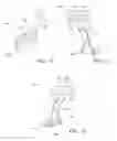 Fig. 06 - Method and internal apparatus for determining final position of dentate skeleton in orthognathic surgery