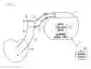 Fig. 01 - Method and apparatus for controlling autonomic balance using neural stimulation
