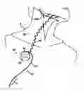 Fig. 01 - Obstructive Sleep Apnea Treatment Devices, Systems and Methods