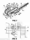 Fig. 06 - Obstructive Sleep Apnea Treatment Devices, Systems and Methods