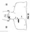 Fig. 08 - Obstructive Sleep Apnea Treatment Devices, Systems and Methods