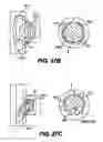 Fig. 22 - Obstructive Sleep Apnea Treatment Devices, Systems and Methods