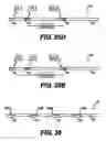 Fig. 32 - Obstructive Sleep Apnea Treatment Devices, Systems and Methods